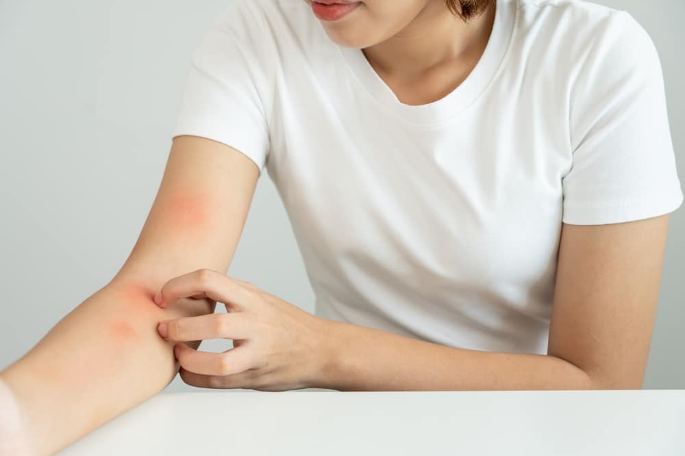 living with Systemic Lupus