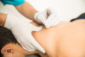 Milford psoriasis arthritis natural treatment