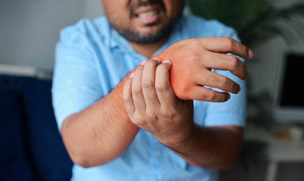 psoriasis_patient