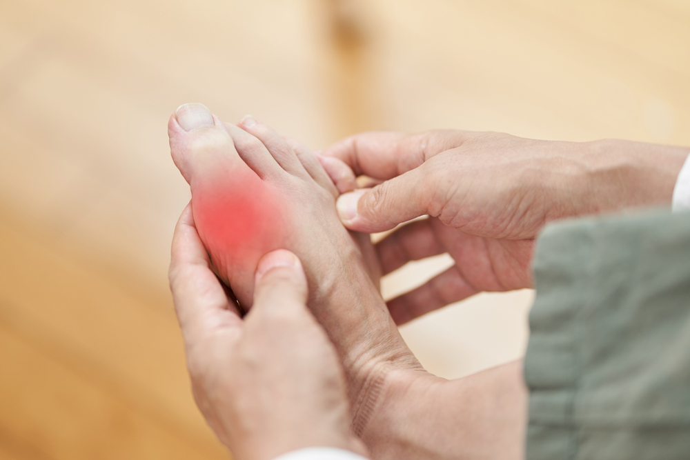 gout treatment milford delaware rheumatology center