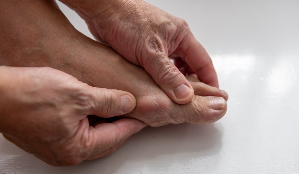 gout treatment near brent jordan way milford de
