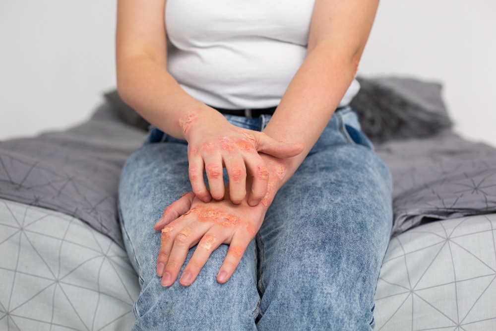 vasculitis rash joint pain rheumatologist dover de